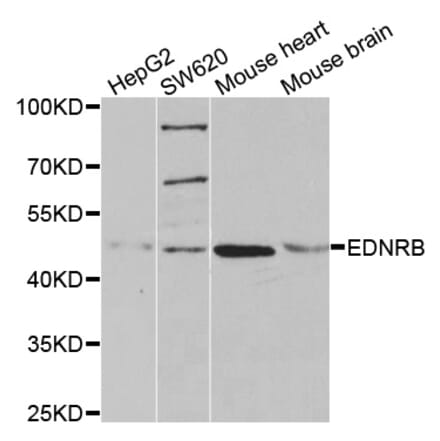 Western blot - EDNRB antibody from Signalway Antibody (38492) - Antibodies.com