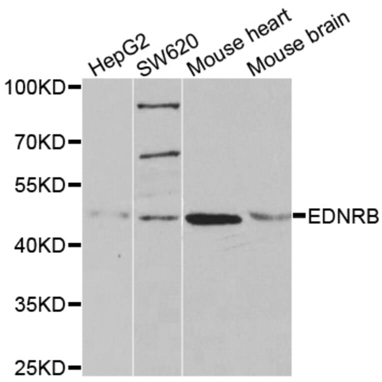 Western blot - EDNRB antibody from Signalway Antibody (38492) - Antibodies.com