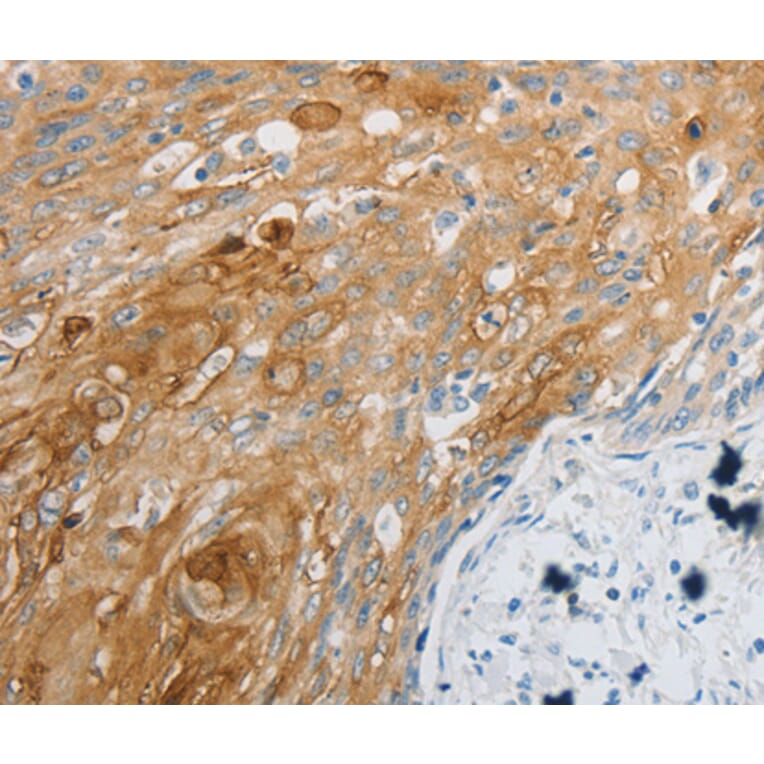 Immunohistochemistry - EDNRB antibody from Signalway Antibody (38492) - Antibodies.com