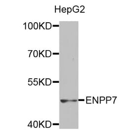 Western blot - ENPP7 antibody from Signalway Antibody (38494) - Antibodies.com