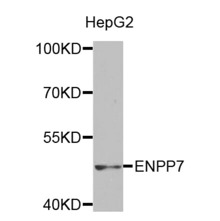 Western blot - ENPP7 antibody from Signalway Antibody (38494) - Antibodies.com