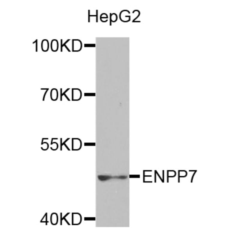 Western blot - ENPP7 antibody from Signalway Antibody (38494) - Antibodies.com