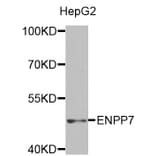 Western blot - ENPP7 antibody from Signalway Antibody (38494) - Antibodies.com