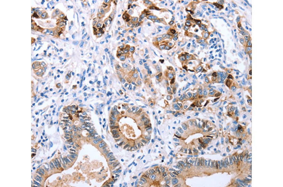 Immunohistochemistry - CXCR3 antibody from Signalway Antibody (38502) - Antibodies.com