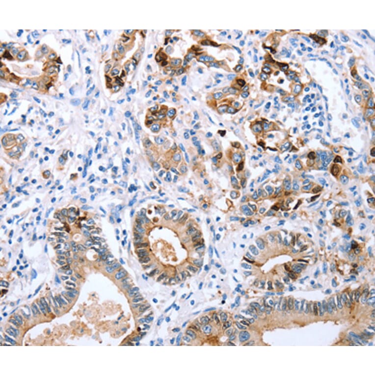 Immunohistochemistry - CXCR3 antibody from Signalway Antibody (38502) - Antibodies.com