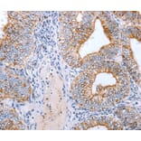 Immunohistochemistry - CLDN3 antibody from Signalway Antibody (38504) - Antibodies.com