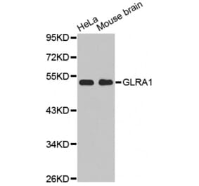 Western blot - GLRA1 antibody from Signalway Antibody (38507) - Antibodies.com