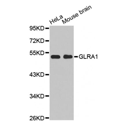 Western blot - GLRA1 antibody from Signalway Antibody (38507) - Antibodies.com