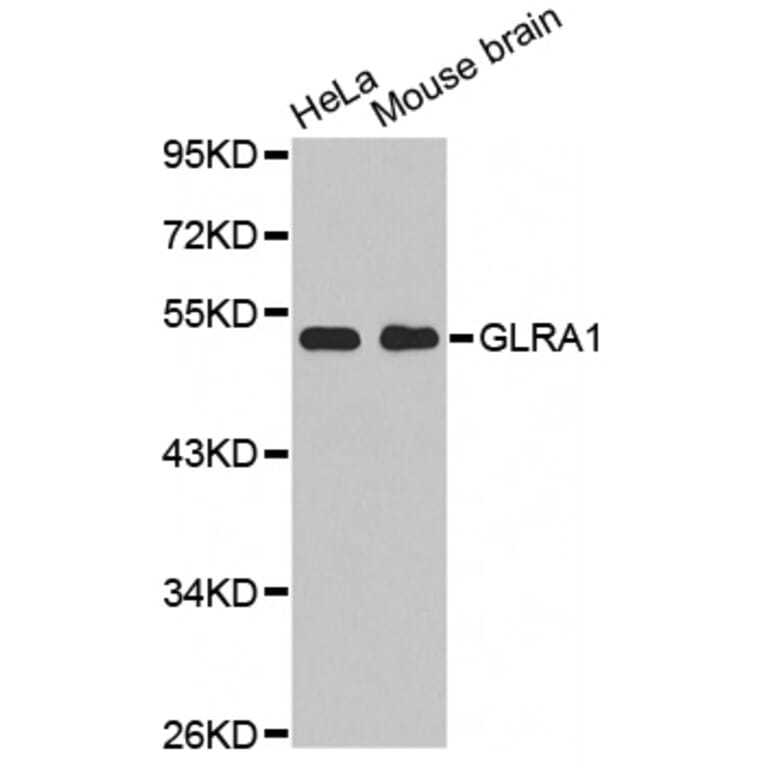 Western blot - GLRA1 antibody from Signalway Antibody (38507) - Antibodies.com