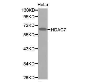 Western blot - HDAC7 antibody from Signalway Antibody (38516) - Antibodies.com