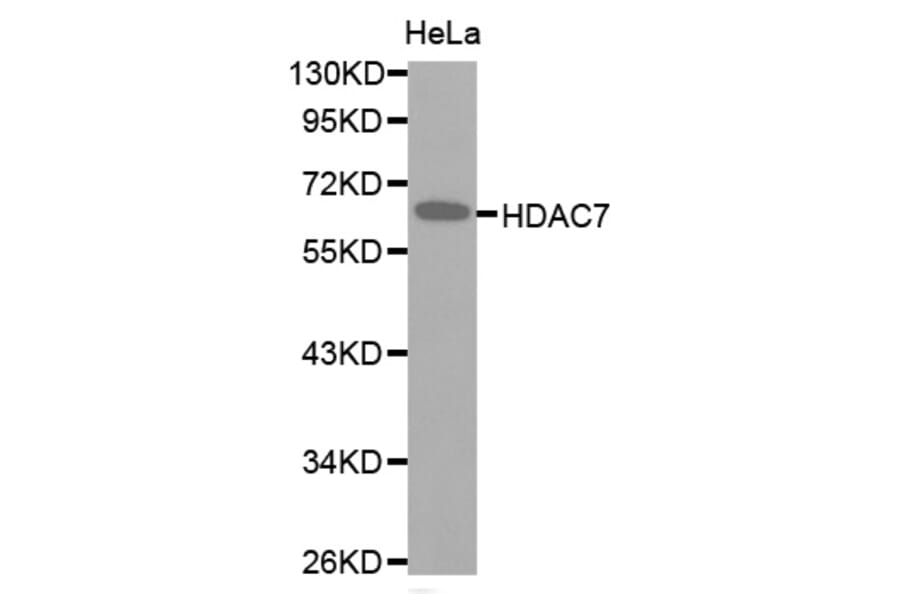 Western blot - HDAC7 antibody from Signalway Antibody (38516) - Antibodies.com
