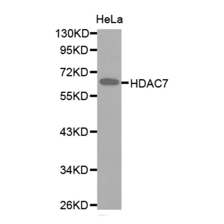 Western blot - HDAC7 antibody from Signalway Antibody (38516) - Antibodies.com