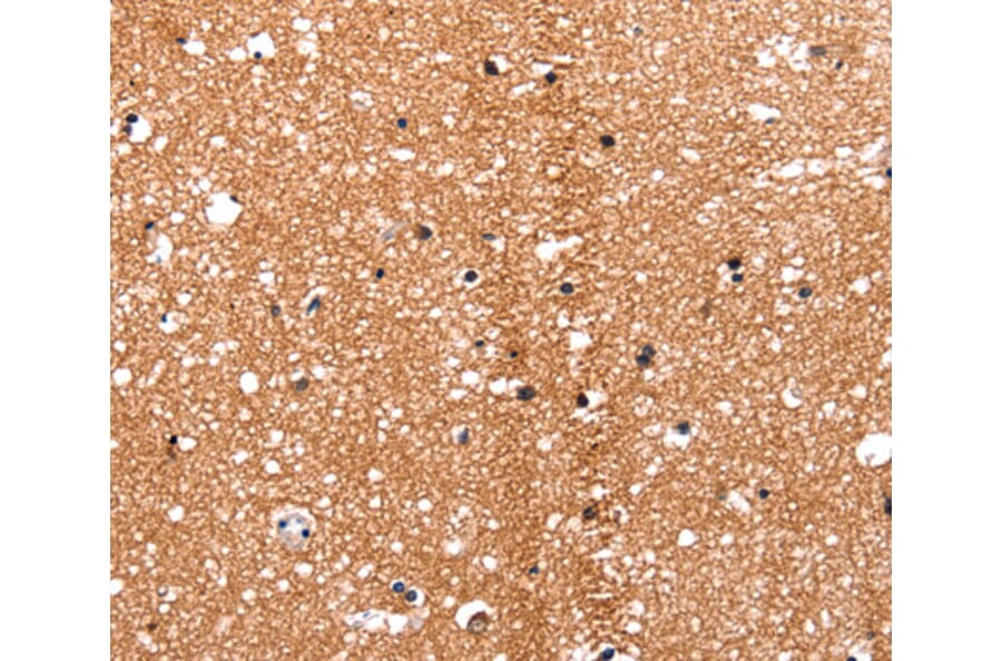 Immunohistochemistry - HDAC7 antibody from Signalway Antibody (38516) - Antibodies.com