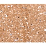 Immunohistochemistry - HDAC7 antibody from Signalway Antibody (38516) - Antibodies.com