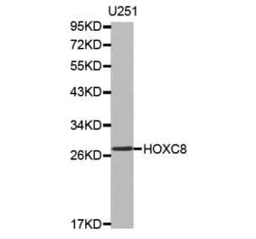 Western blot - HOXC8 antibody from Signalway Antibody (38519) - Antibodies.com