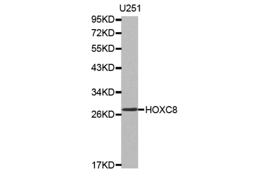 Western blot - HOXC8 antibody from Signalway Antibody (38519) - Antibodies.com
