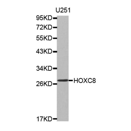 Western blot - HOXC8 antibody from Signalway Antibody (38519) - Antibodies.com