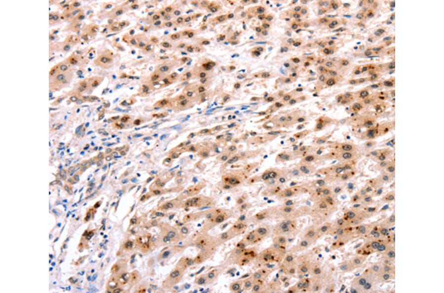 Immunohistochemistry - HOXC8 antibody from Signalway Antibody (38519) - Antibodies.com