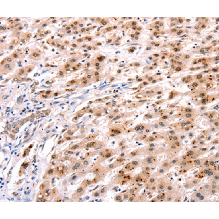 Immunohistochemistry - HOXC8 antibody from Signalway Antibody (38519) - Antibodies.com