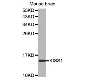 Western blot - KISS1 antibody from Signalway Antibody (38524) - Antibodies.com