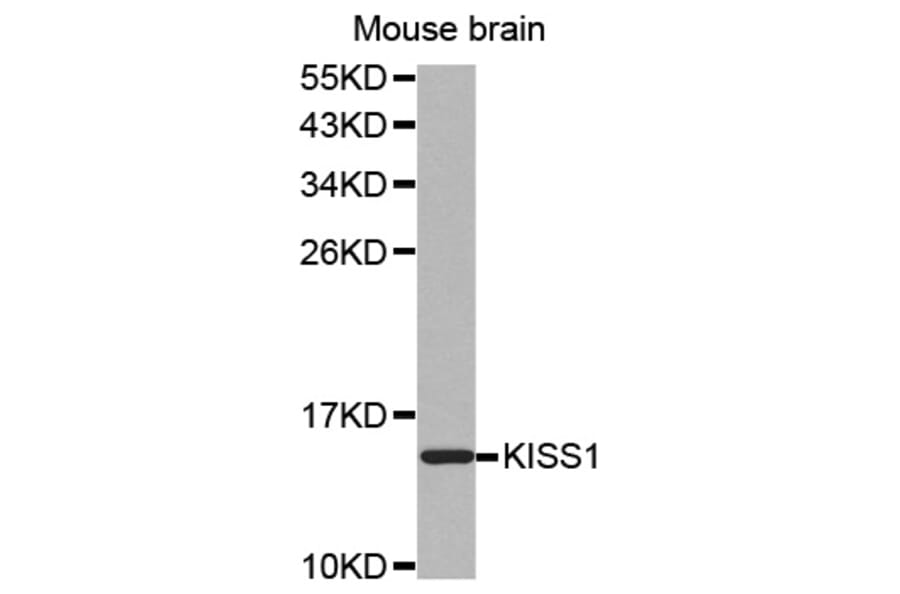 Western blot - KISS1 antibody from Signalway Antibody (38524) - Antibodies.com