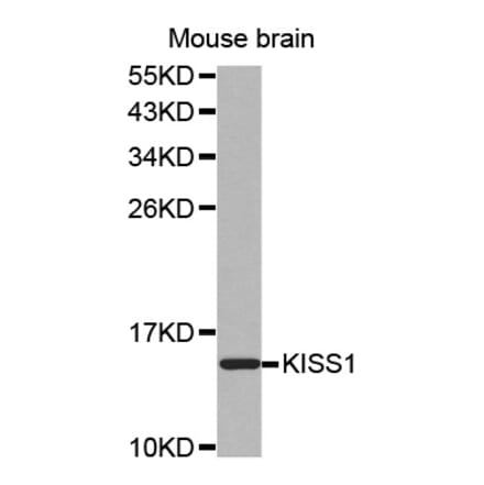 Western blot - KISS1 antibody from Signalway Antibody (38524) - Antibodies.com