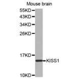 Western blot - KISS1 antibody from Signalway Antibody (38524) - Antibodies.com