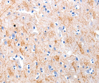 Anti-KISS1 Antibody (A38132) | Antibodies.com