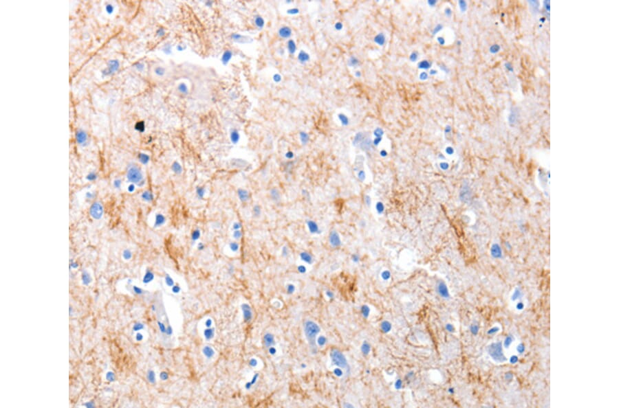 Immunohistochemistry - KISS1 antibody from Signalway Antibody (38524) - Antibodies.com