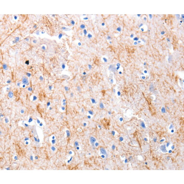 Immunohistochemistry - KISS1 antibody from Signalway Antibody (38524) - Antibodies.com