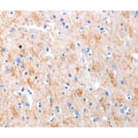 Immunohistochemistry - KISS1 antibody from Signalway Antibody (38524) - Antibodies.com