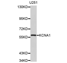 Western blot - KCNA1 antibody from Signalway Antibody (38529) - Antibodies.com