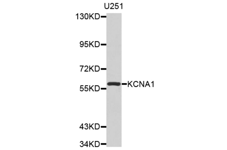 Western blot - KCNA1 antibody from Signalway Antibody (38529) - Antibodies.com