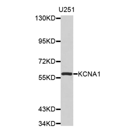 Western blot - KCNA1 antibody from Signalway Antibody (38529) - Antibodies.com