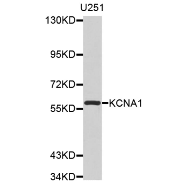 Western blot - KCNA1 antibody from Signalway Antibody (38529) - Antibodies.com