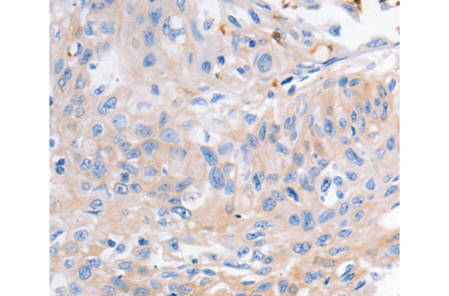 Immunohistochemistry - KCNA1 antibody from Signalway Antibody (38529) - Antibodies.com