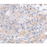 Immunohistochemistry - KCNA1 antibody from Signalway Antibody (38529) - Antibodies.com