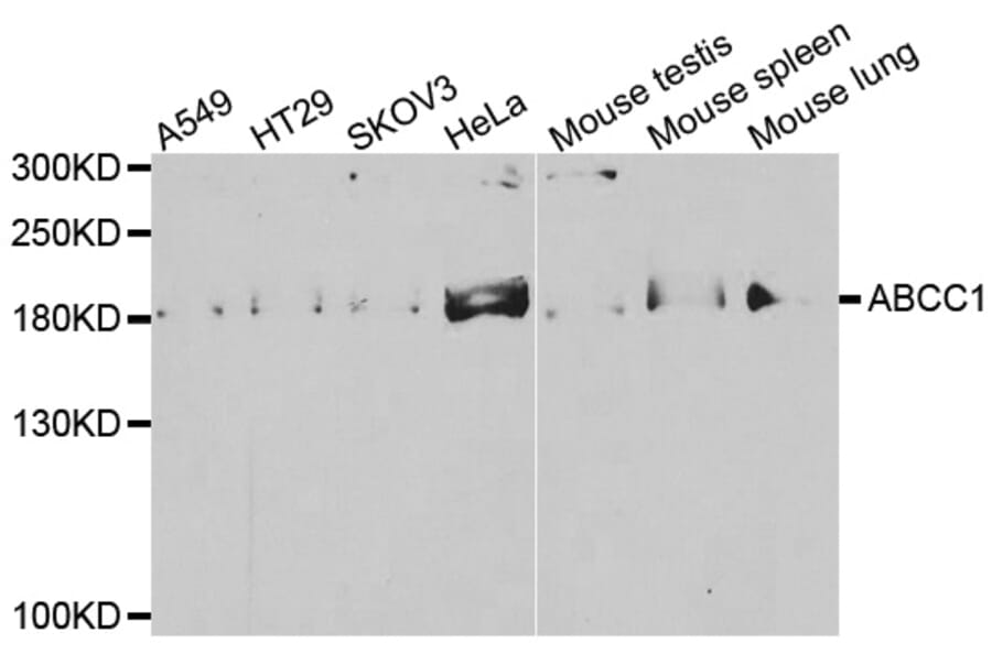 Western blot - ABCC1 antibody from Signalway Antibody (38541) - Antibodies.com