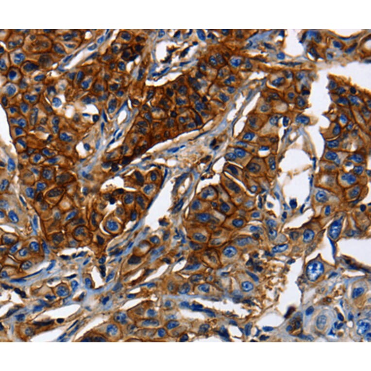 Immunohistochemistry - ABCC5 antibody from Signalway Antibody (38542) - Antibodies.com