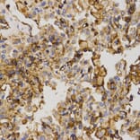 Immunohistochemistry - ABCC5 antibody from Signalway Antibody (38542) - Antibodies.com