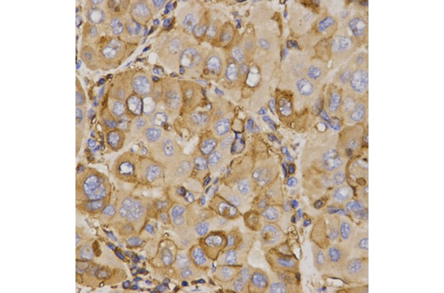 Immunohistochemistry - ABCC5 antibody from Signalway Antibody (38542) - Antibodies.com