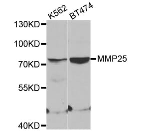 Western blot - MMP25 antibody from Signalway Antibody (38544) - Antibodies.com