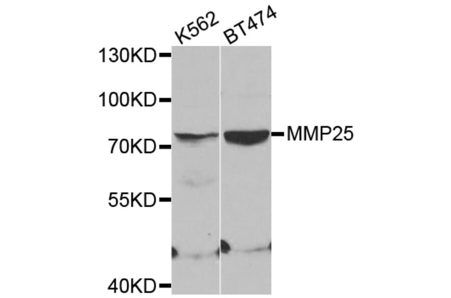 Western blot - MMP25 antibody from Signalway Antibody (38544) - Antibodies.com