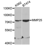 Western blot - MMP25 antibody from Signalway Antibody (38544) - Antibodies.com