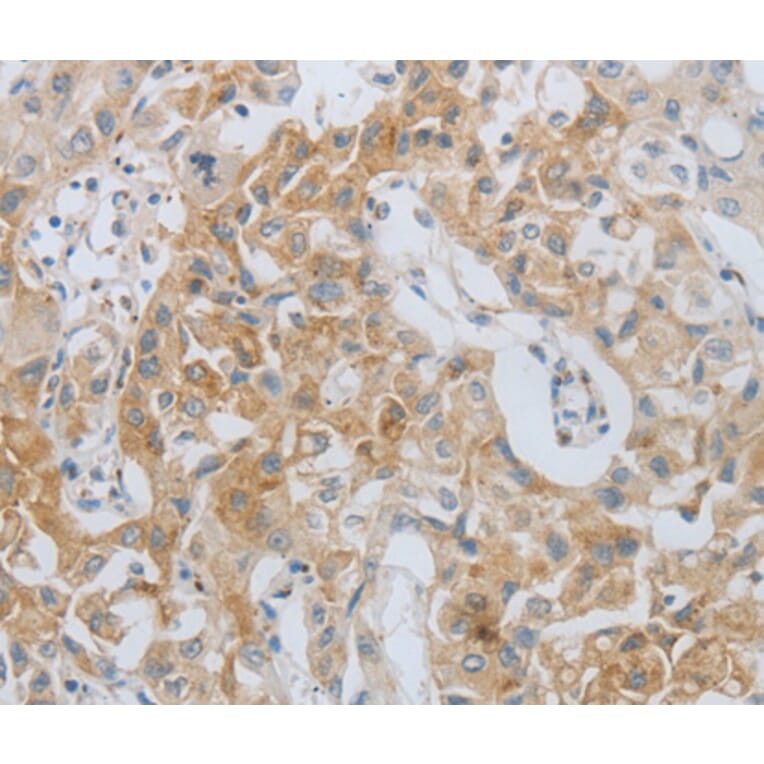 Immunohistochemistry - MMP25 antibody from Signalway Antibody (38544) - Antibodies.com