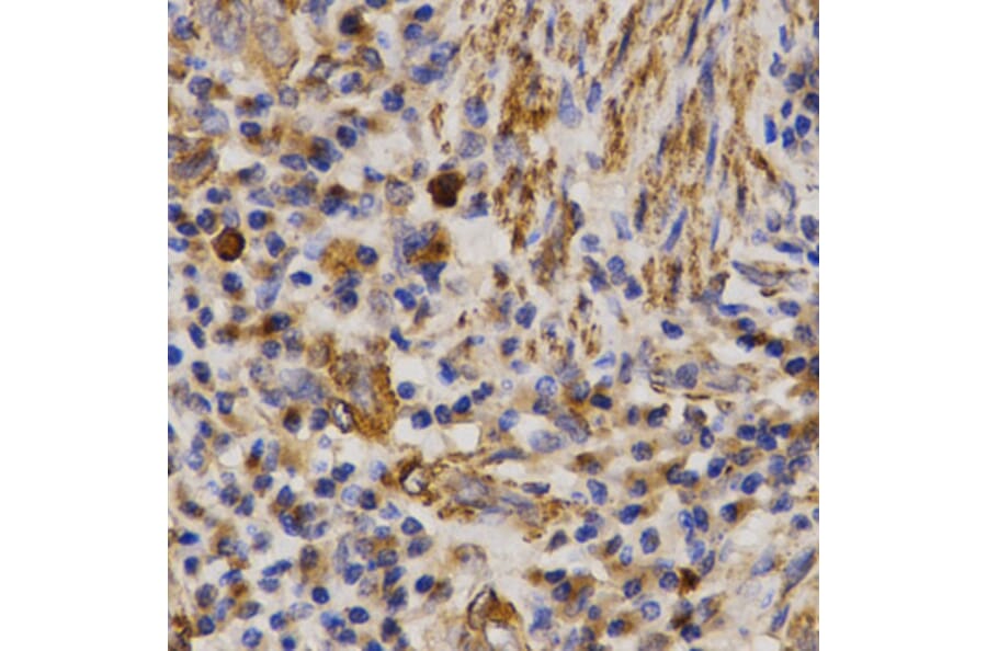Immunohistochemistry - MMP25 antibody from Signalway Antibody (38544) - Antibodies.com