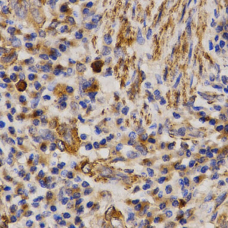 Immunohistochemistry - MMP25 antibody from Signalway Antibody (38544) - Antibodies.com