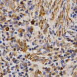 Immunohistochemistry - MMP25 antibody from Signalway Antibody (38544) - Antibodies.com