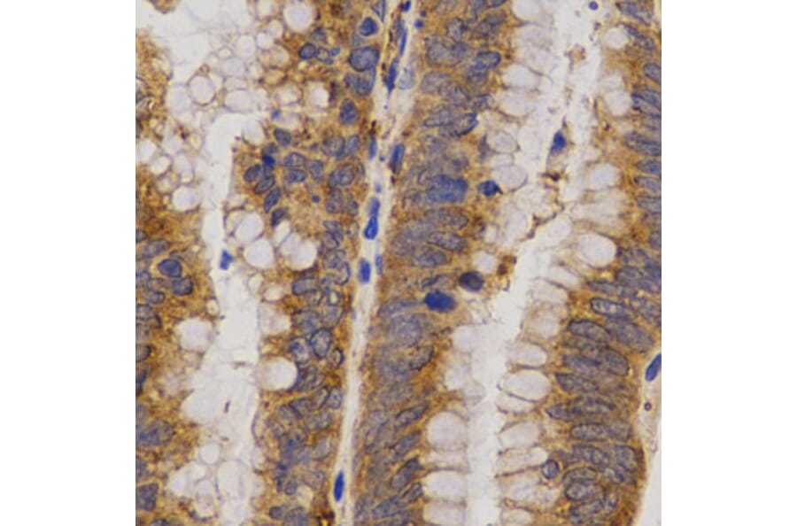 Immunohistochemistry - MMP25 antibody from Signalway Antibody (38544) - Antibodies.com