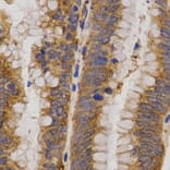Immunohistochemistry - MMP25 antibody from Signalway Antibody (38544) - Antibodies.com